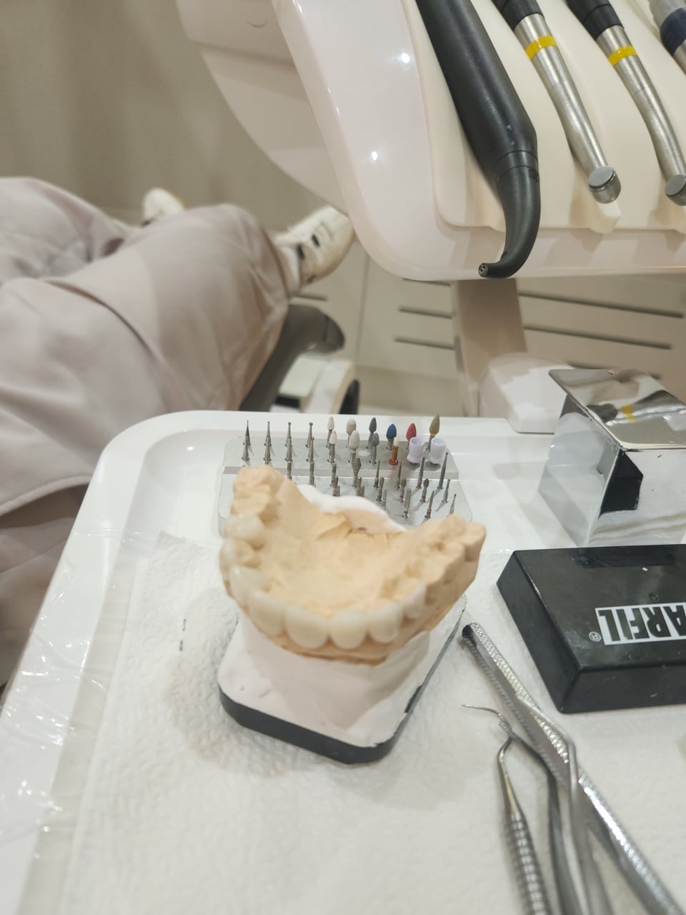 A dental model on the tray beside the treatment chair