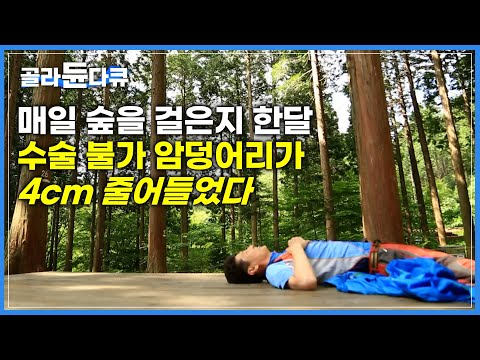 어싱을 한 사람들의 경험