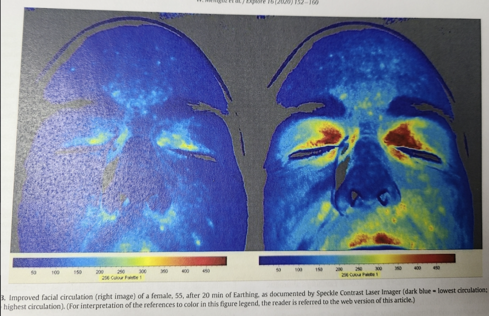 어싱 논문 분석3