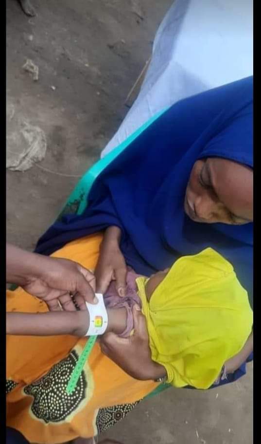 MUAC screening for a child at a NASDO MCH