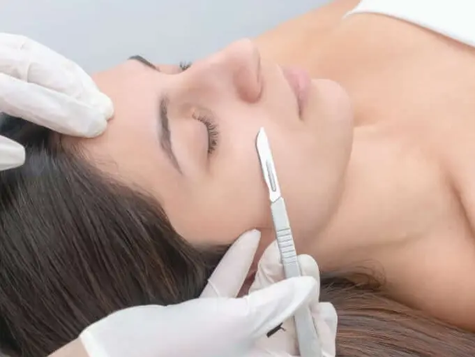 Dermaplaning 