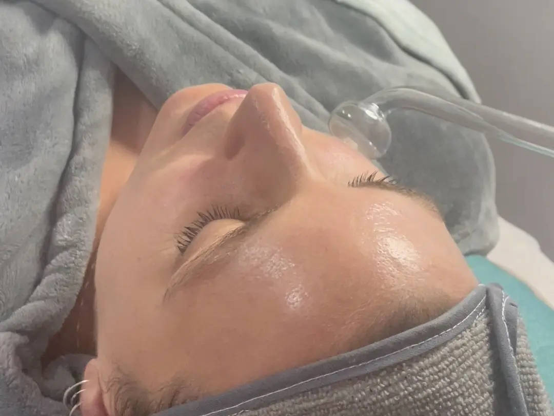 Limpieza facial profunda