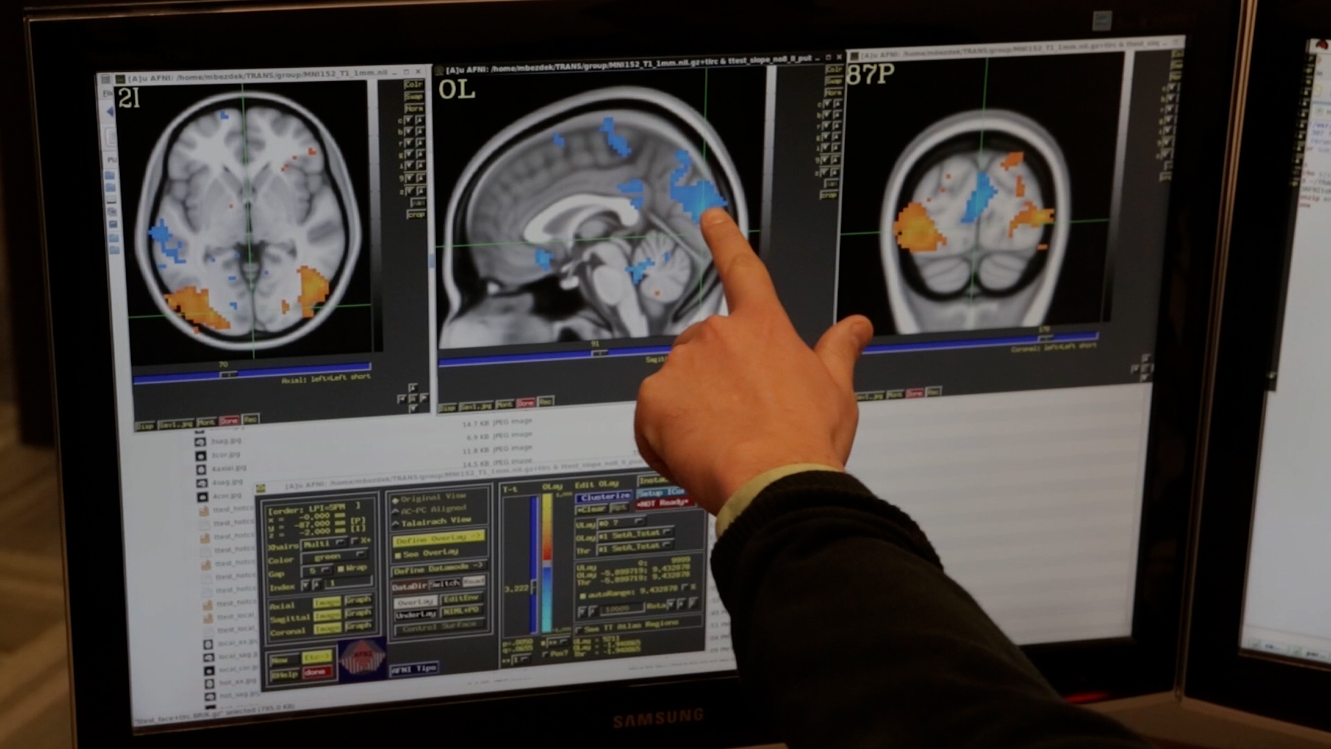 Daily Walking May Reduce Alzheimer's Risk, New Study Suggests