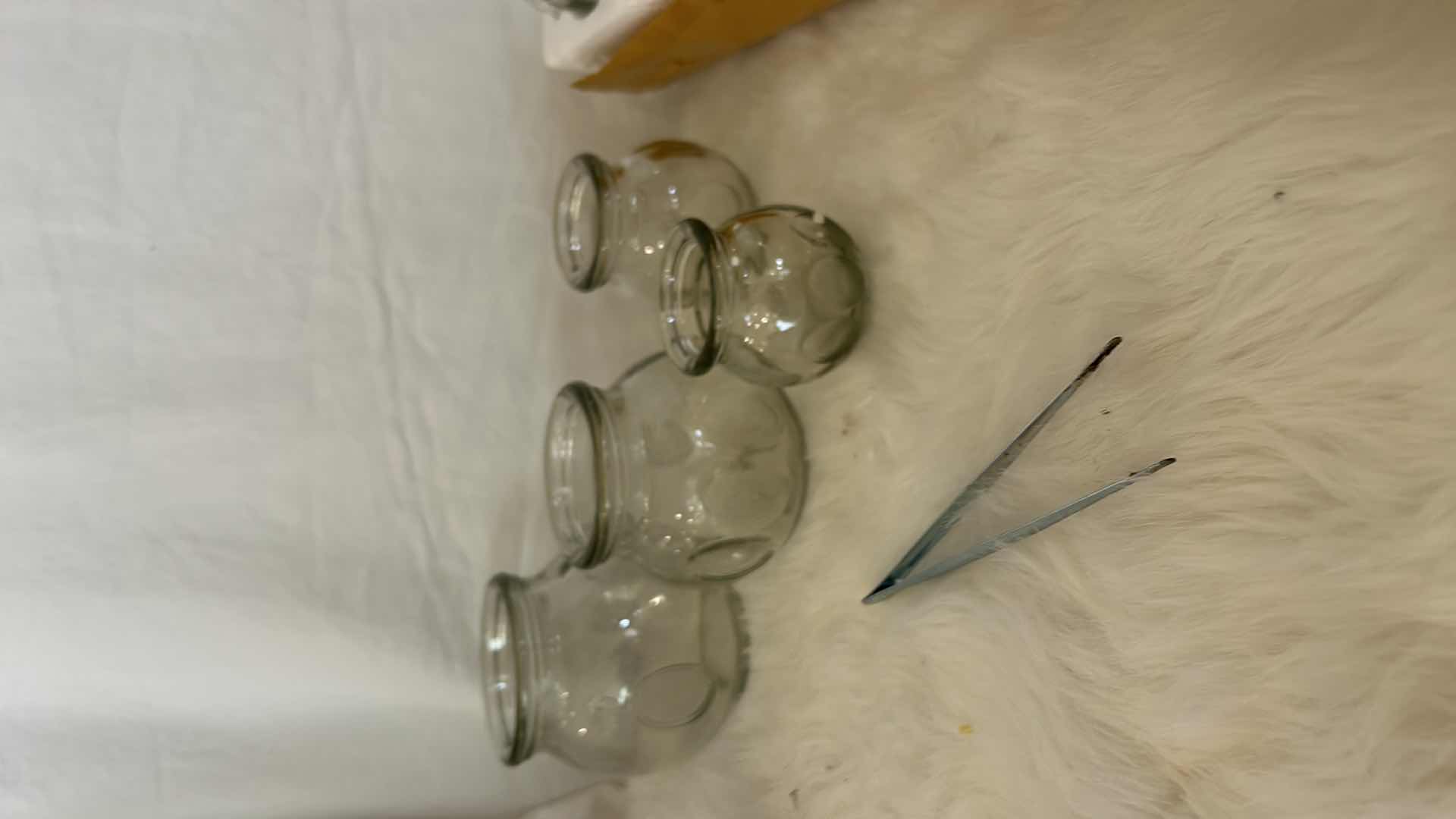 Photo 1 of PROFESSIONAL GLASS MEDICAL CUPPING KIT