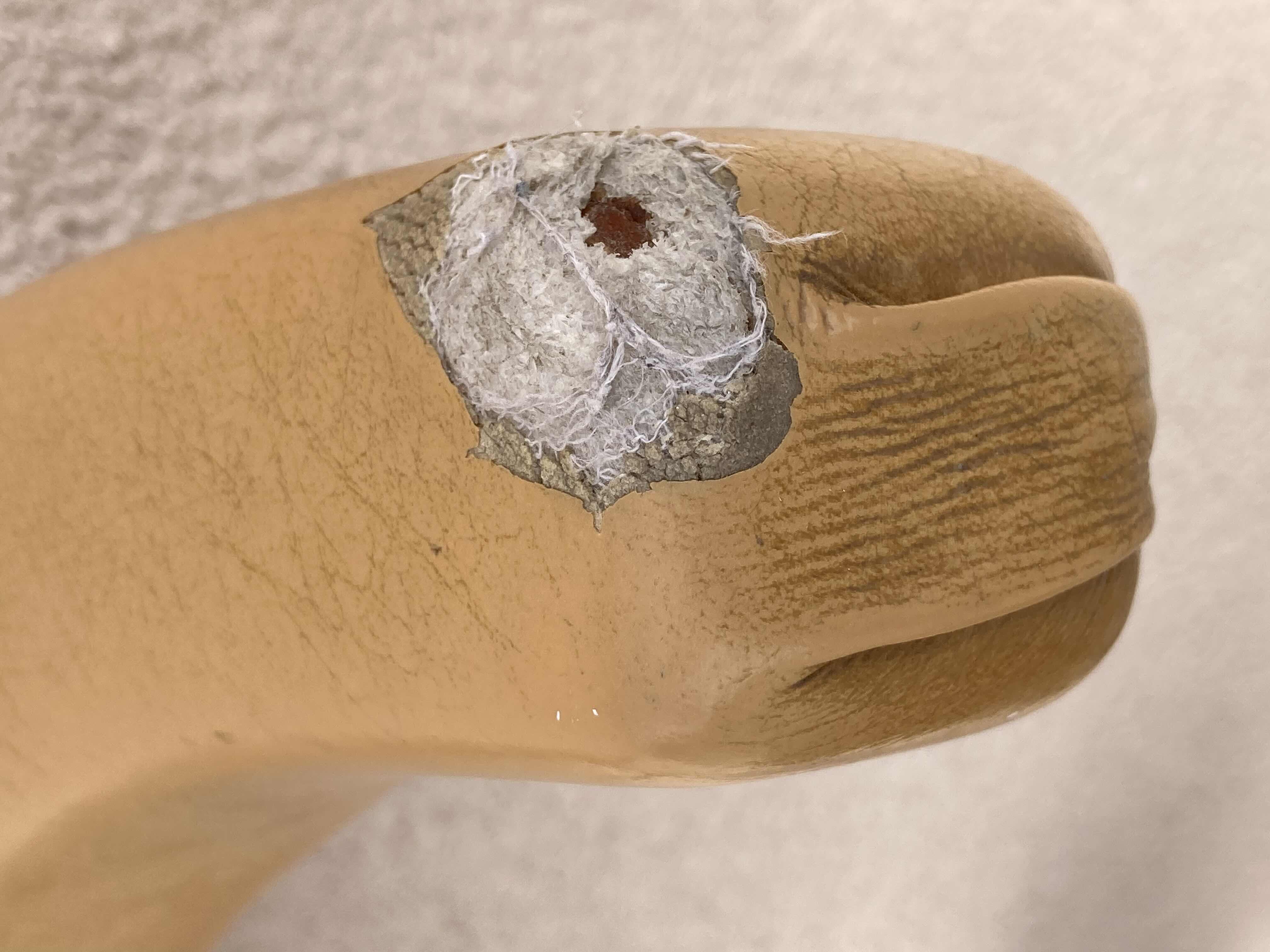 Photo 1 of DENTAL ROLLING SWIVEL CHAIR 24” X 23” H34.5”