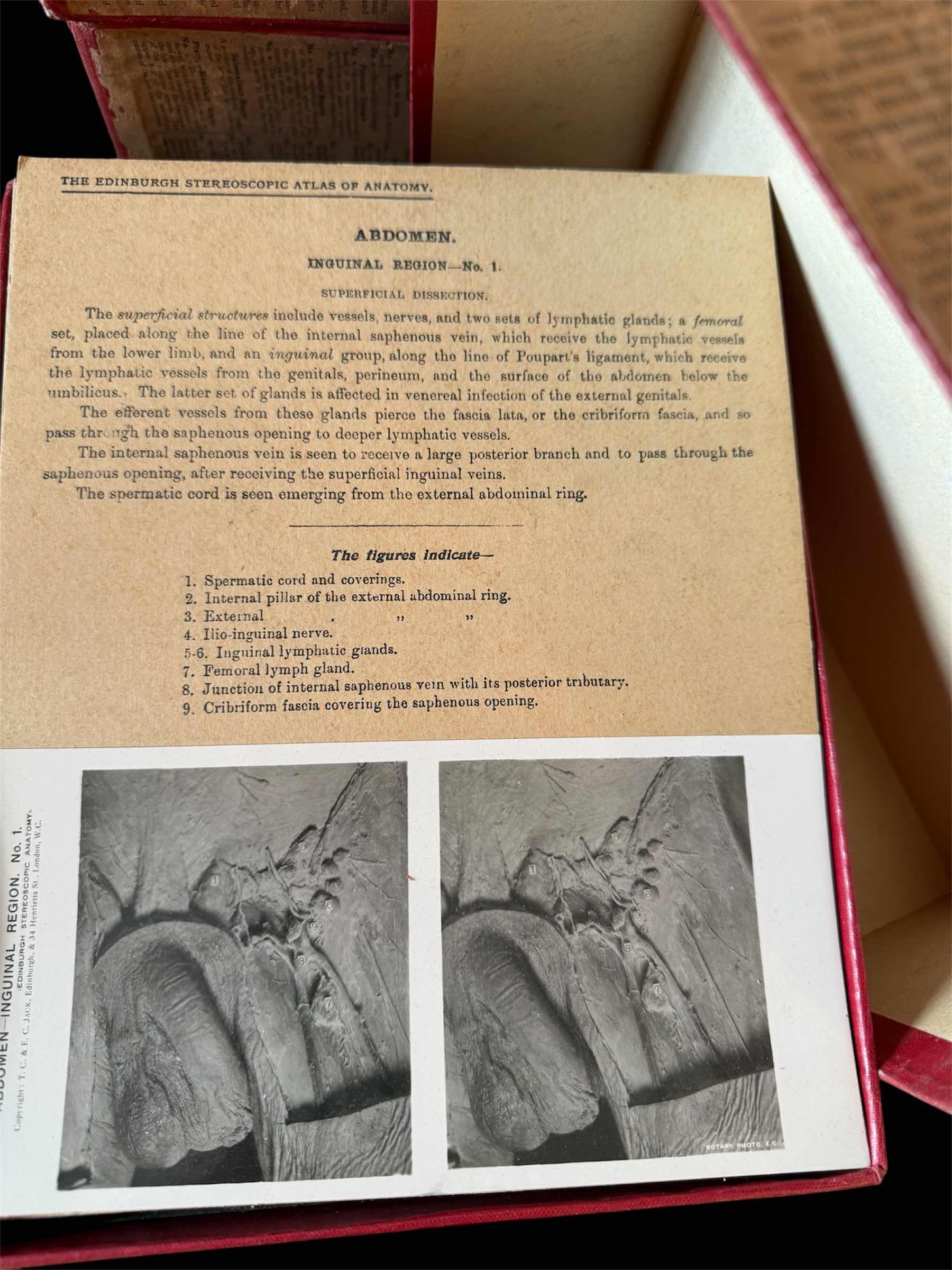 Photo 1 of 4 VOLUMES- RARE EDINBURGH UNIVERSITY STEREOSCOPIC ANATOMY