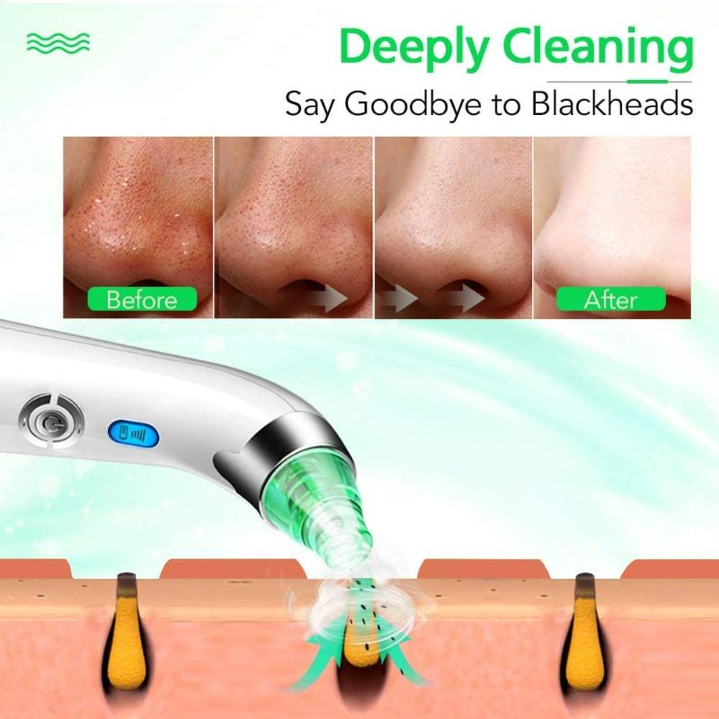 Photo 2 of Pore Vacuum Blackhead Remover - Upgraded Pore Cleanser Blackhead Removal Rechargeable Face Vacuum Comedone Whitehead Extractor Tool with 5 Adjustable Levels of Suction Power and 4 Porbes