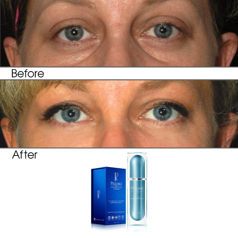 Photo 2 of INTENSIVE RAPID RENEWAL EYE ANT  AGE SERUM REDUCES DARK CIRCLES PUFFINESS FINE LINES AND WRINKLES IMPROVES ELASTICITY AND FIRMNESS NEW 
$850