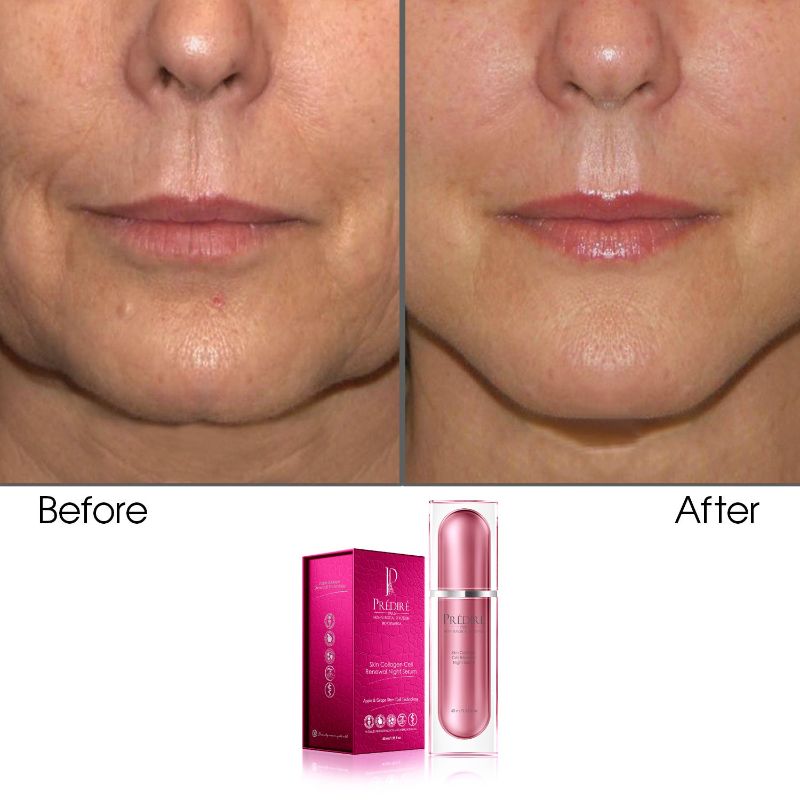 Photo 2 of RENEWAL NIGHT SERUM MOISTURIZES HYDRATES AND BRIGHTENS DECREASES FINE LINES WRINKLES SPOTS AND SUN DAMAGE PREVENTS PREMATURE AGING NEW IN BOX
$750
