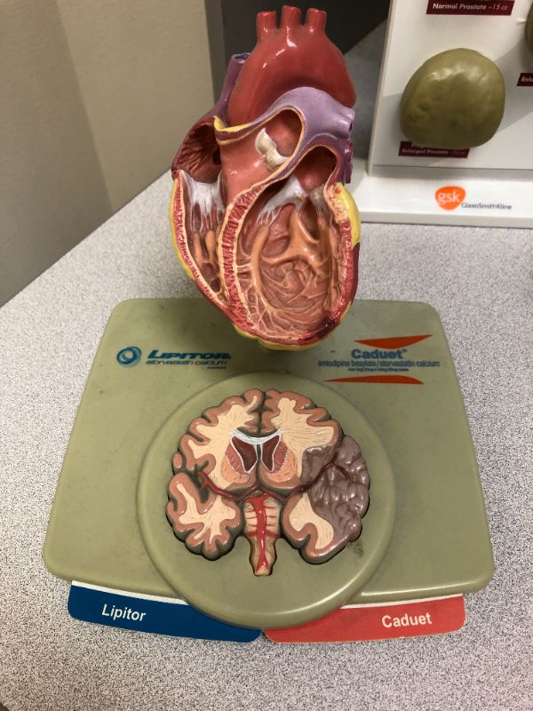 Photo 4 of Medical mason jars and 3d diagrams with facts.