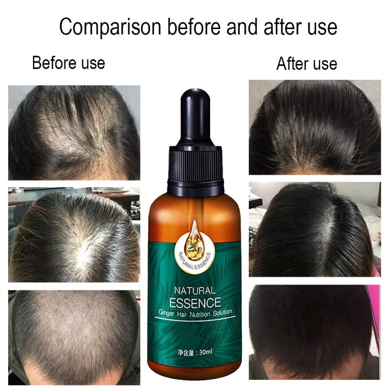 Photo 1 of 7X Rapid Growth Hair Treatment 7 Day Hair Growth Serum Essence Oil Regrow, with Natural Vitamin Rich Treatm, for Fuller Healthier Hair, Prevent Hair Loss and Thinn 2 bottle
