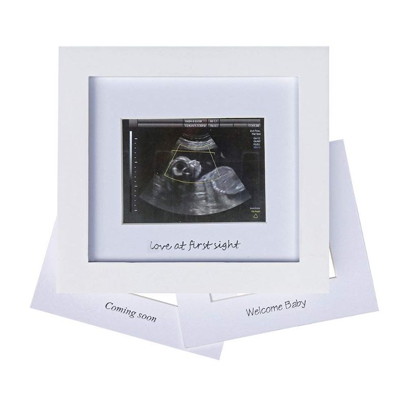 Photo 1 of BABY SONOGRAM PHOTO FRAME 1ST ULTRASOUND PICTURE FRAME
