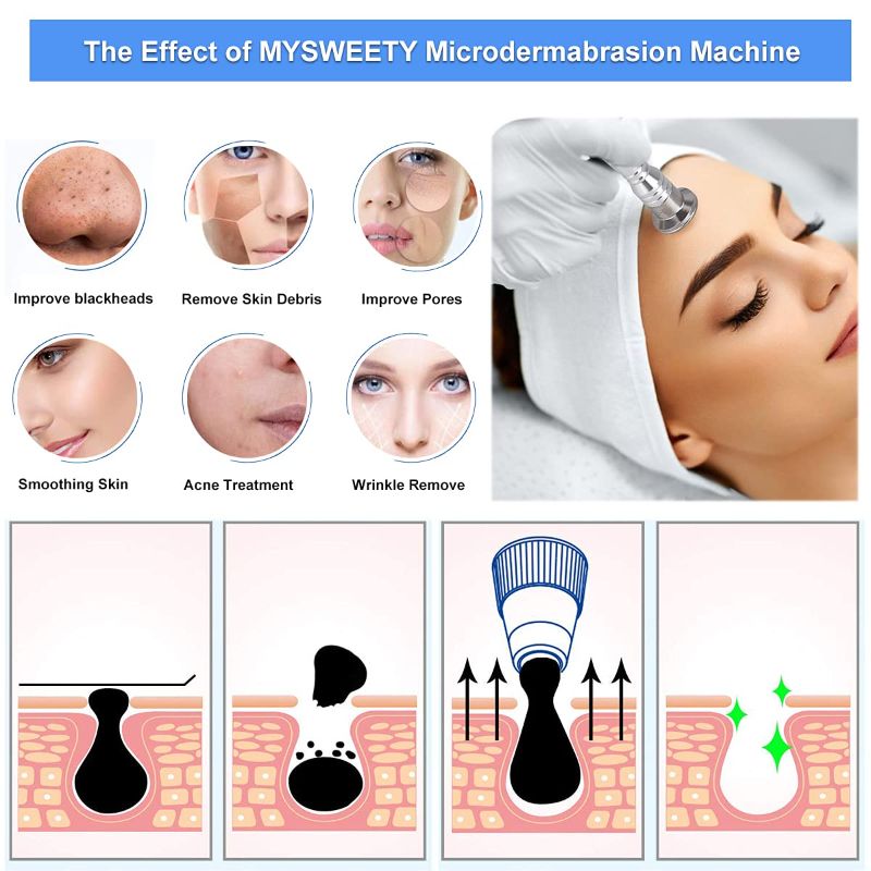 Photo 2 of Diamond Microdermabrasion Machine, MYSWEETY 65-68cmHg Suction Power Professional Diamond Dermabrasion Machine, Home Use Facial Skin Care Equipment Beauty Machine with 300pcs Cotton Filter
