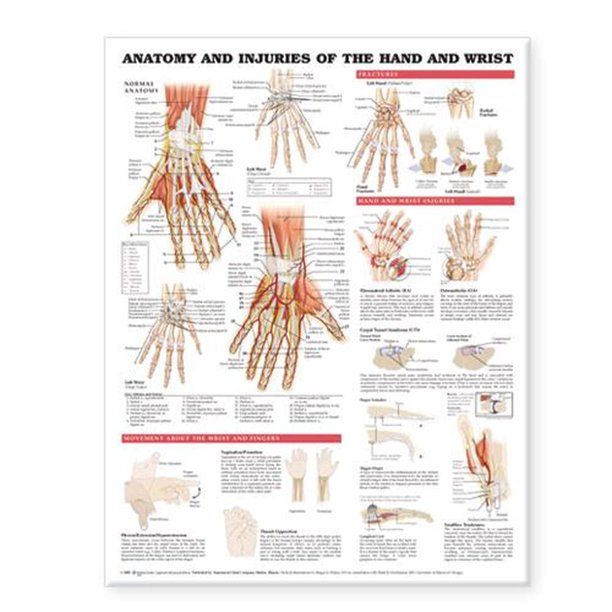 Photo 1 of Anatomy and Injuries of the Hand and Wrist Anatomical Chart 20" x 26"
