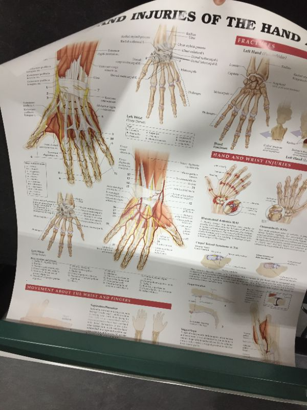 Photo 2 of Anatomy and Injuries of the Hand and Wrist Anatomical Chart 20" x 26"
