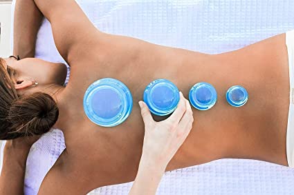 Photo 1 of Lure Essentials Edge Cupping Set – Ultra Clear Blue Silicone Cupping Therapy Set for Cellulite Reduction and Myofascial Release - Massage Therapists and Home Use (Set of 4, Blue)
