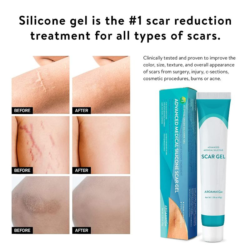 Photo 3 of Aroamas Scar Advanced Scar Gel - Medical-Grade Silicone Scar Gel for Surgical Scars, for Face, Scar gel with silicone for Keloids, C-Section, Cosmetic Procedures, Burns, Injuries - 45g