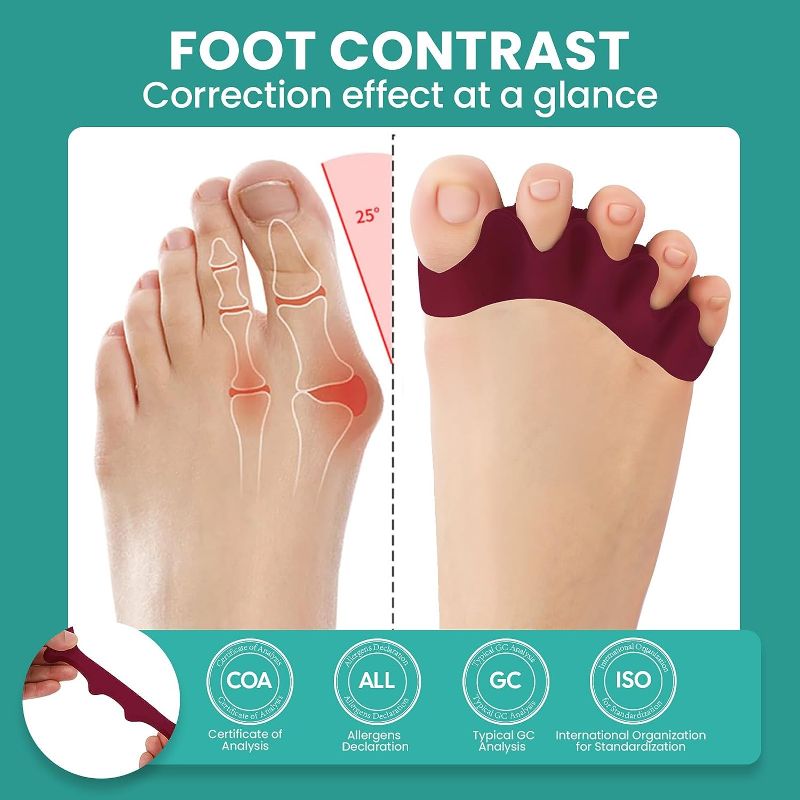 Photo 1 of PLEASE SEE PHOTO 
Toe Separator Bunion Corrector - 8 Pcs Gel Toe Straightener to Restore Hammertoes to Their Original Shape for Women Men, Toe Spacers for Gifts Pale skin color
