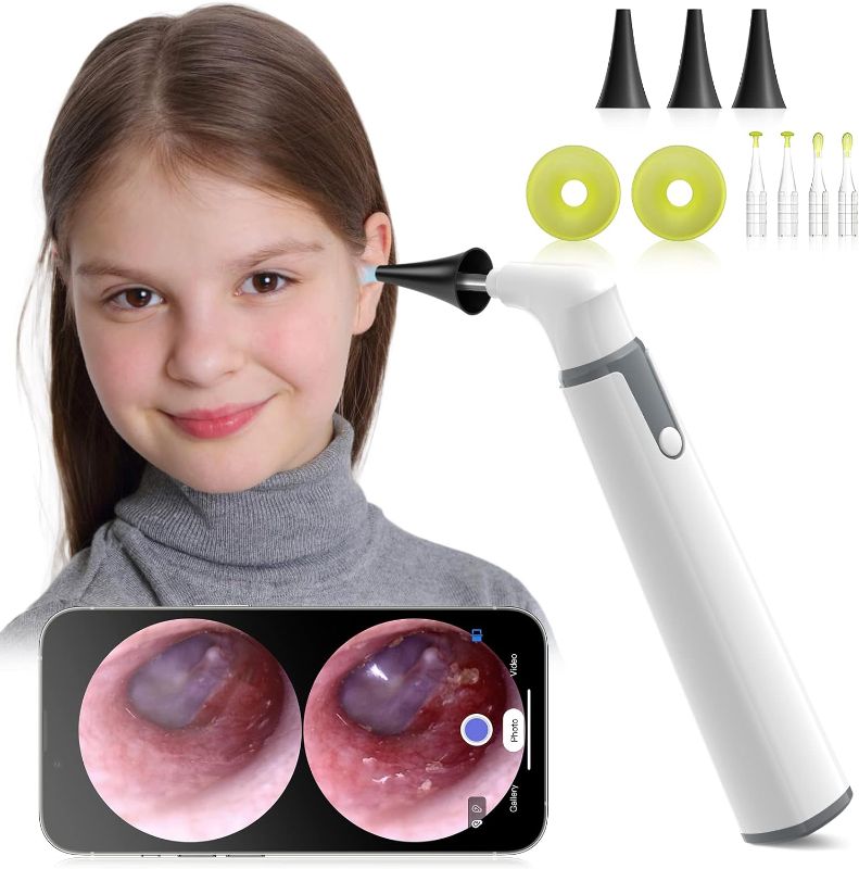Photo 1 of Anykit Wireless Otoscope Ear Camera with Dual View, 3.9mm 720PHD WiFi Ear Scope with Ear Wax Removal Tool for Kids and Adults & Pets, Compatible with Android and iPhone
