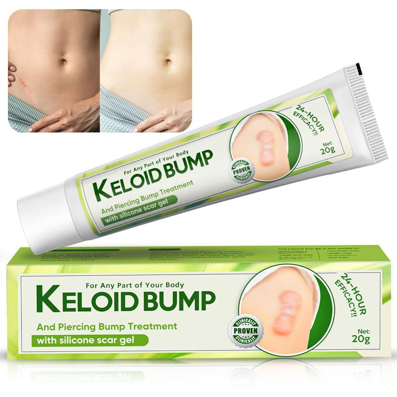 Photo 1 of Keloid Bump Removal,Scar Cream Gel for Face, Body, Surgical Scars,Stretch Mark,Old & New Scars,Professional & Gentle Keloid Scar Treatment
