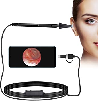 Photo 1 of Jiusion 3.9mm Ultra-Thin Portable USB Digital Otoscope Camera with Carrying Case, HD 720P 6 LED Visual Ear Scope with 3 Hats 2 Silicone Caps 8 Earwax Spoons for Android Windows Mac NOT for iPhone iPad
