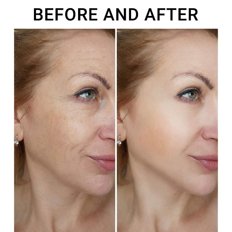 Photo 1 of Galeboy Neck Firming Cream, Anti Aging Moisturizer for Neck & Décolleté, Neck Cream, Double Chin Reducer, Skin Tightening Cream