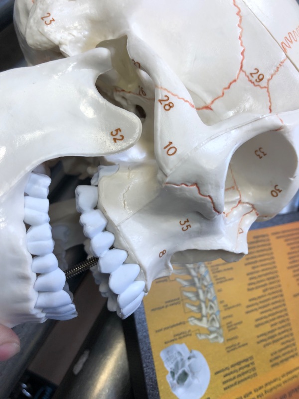 Photo 5 of 360°Rotatable Upgraded Life Size Human Skull on Cervical Vertebrae Anatomical Model with Spinal Nerves and Arteries with Newest Laser-Etched Fonts Not Hand Write Number,Not Smudged for Medical Student