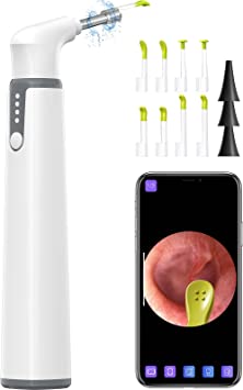 Photo 1 of ScopeAround Otoscope Ear wax Removal Camera, Ear Scope with 3.9mm Ultra-Thin Lens, Ear Cleaning Camera with Lights, Otoscope Camera for Children and Adults, Otoscope Compatible with iPhone and Android
