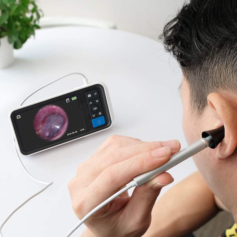 Photo 5 of Digital Otoscope with 4.5 Inches Screen, Anykit 3.9mm Ear Camera with 6 LED Lights, 32GB Card, Ear Wax Removal Tool, Specula and 2500 mAh Rechargeable Battery, Supports Photo Snap and Video Recording   