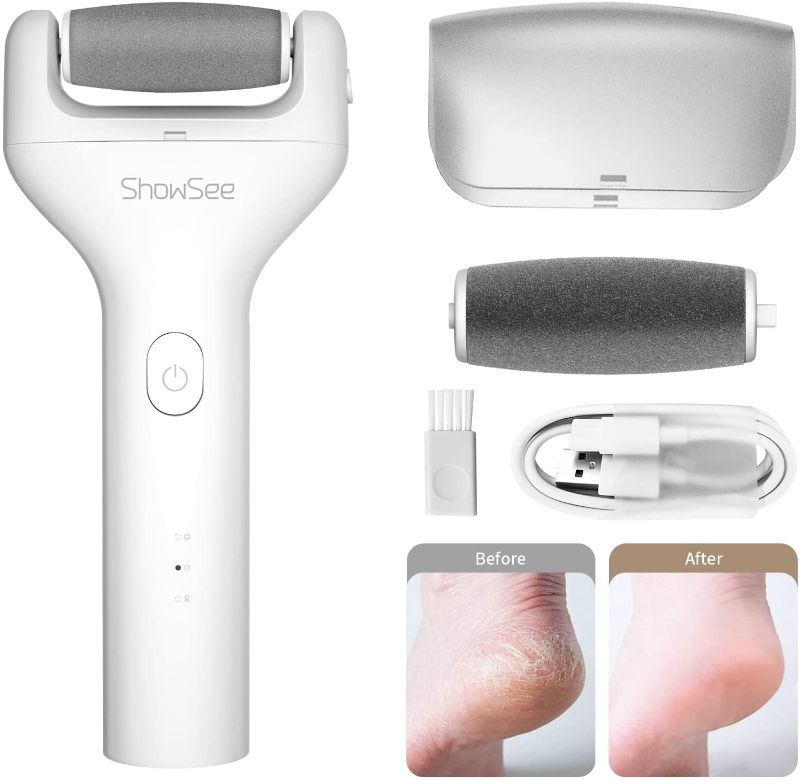 Photo 1 of ShowSee Dead Skin Remover for Feet,Pressure Sensing Electric Callus Remover - IPX7 Fully Waterproof, Pedicure Electric Foot Callus Remover with Replaceable Grinding Heads, B1 White
