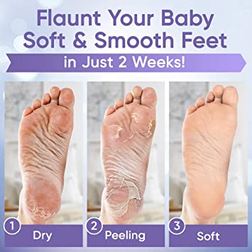 Photo 1 of ??Foot Peel Mask (3 Pairs) - Foot Mask for Baby soft skin - Remove Dead Skin | Foot Spa Foot Care for women Peel Mask with Lavender and Aloe Vera Gel for Men and Women Feet Peeling Mask Exfoliating