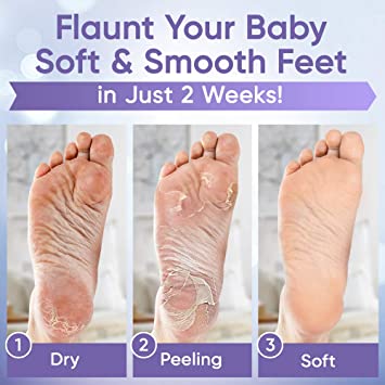Photo 1 of ??Foot Peel Mask (2 Pairs) - Foot Mask for Baby soft skin - Remove Dead Skin | Foot Spa Foot Care for women Peel Mask with Lavender and Aloe Vera Gel for Men and Women Feet Peeling Mask Exfoliating