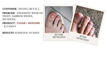 Photo 1 of Drs. Kline + Green Clear + Restore Nail Treatment .90 oz - 3 Month Supply
