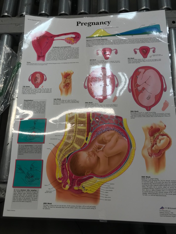 Photo 2 of  PREGNANCY CHART