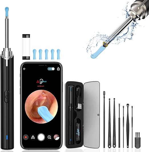 Photo 1 of Ear Wax Removal, Ear Cleaner kit with 1080P Camera, Earwax Camera with 6 LED Lights, Earwax Remover Tool for iOS & Android Phones, Ear Camera for Kids Adults & Pets