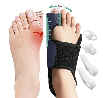 Photo 1 of Donnetty Bunion Corrector for Women and Men, Big Toe Separator Pain Relief, Big Toe Straightener with Splint, Bunion Corrector Pad with Adjustable Strap, Hallux Valgus Brace for Day/Night Support
