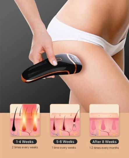 Photo 1 of (READ NOTES) Permanent IPL Hair Removal Device - 999,999 Flashes, Effective Laser Hair Removal for Women and Men
