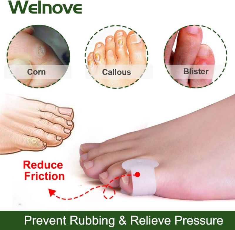 Photo 1 of Welnove Gel Toe Separator, Pinky Toe Spacers, Little Toe Cushions for Preventing Rubbing & Relieve Pressure (Pack of 12)
