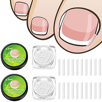 Photo 1 of 100 Pieces Ingrown Toenail Corrector Strips Toenail Correction Patches Curved Toenails Straightening Recover Clips Toenail Straightener Strip for Men Women Foot Care