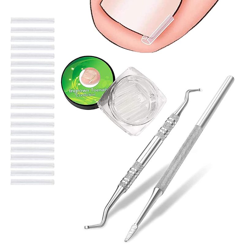 Photo 1 of (50 +2) Pack Professional Ingrown Toenail Correction Treatment Kit, 50 Pcs Ingrown Toenail Corrector Straightener Strips Recover Clips with 2 Pcs Ingrown Toenail File And Lifter
