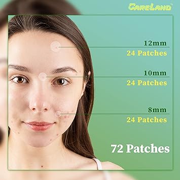 Photo 1 of CARELAND Pimple Patches - Face Hydrocolloid Acne Patches - Invisible Zit Stickers to Cover Blemish Spots & Absorb Breakouts - Calendula Facial Skin Care Product, 3 Sizes (72 Pcs)