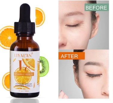 Photo 1 of Vitamin C Serum Combined with Hyaluronic Acid Creates Antioxidants to Smooth and Protect Anti Aging Formula Fights Against Lines and Wrinkles Brightens Skin Tone Created Even Complexion New 