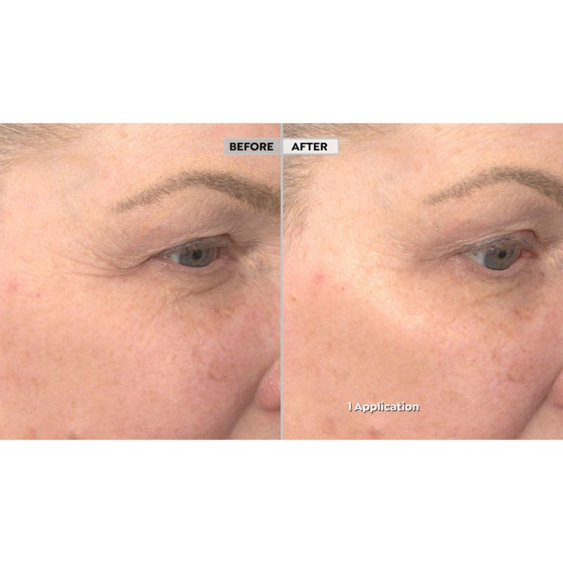 Photo 1 of Hyaluronic & Reishi Mushroom Repairing Serum Hydrates & Detoxifies Reduces Redness Premature Ag-ing & Fine Lines Helps With Allergic Reactions Irritations Bug Bite Dermatitis & Skin Conditions New