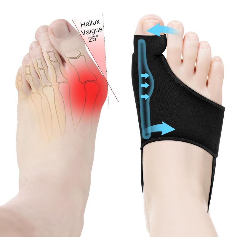 Photo 1 of 2Pcs Bunion Corrector for Women & Men Big Toe Straightener-Bunions Correction Women & Men-Bunion Splint-Bunion Pads for Bunion Relief-Hallux Valgus Pain Relief ,Comfortable & Breathable for Day/Night
