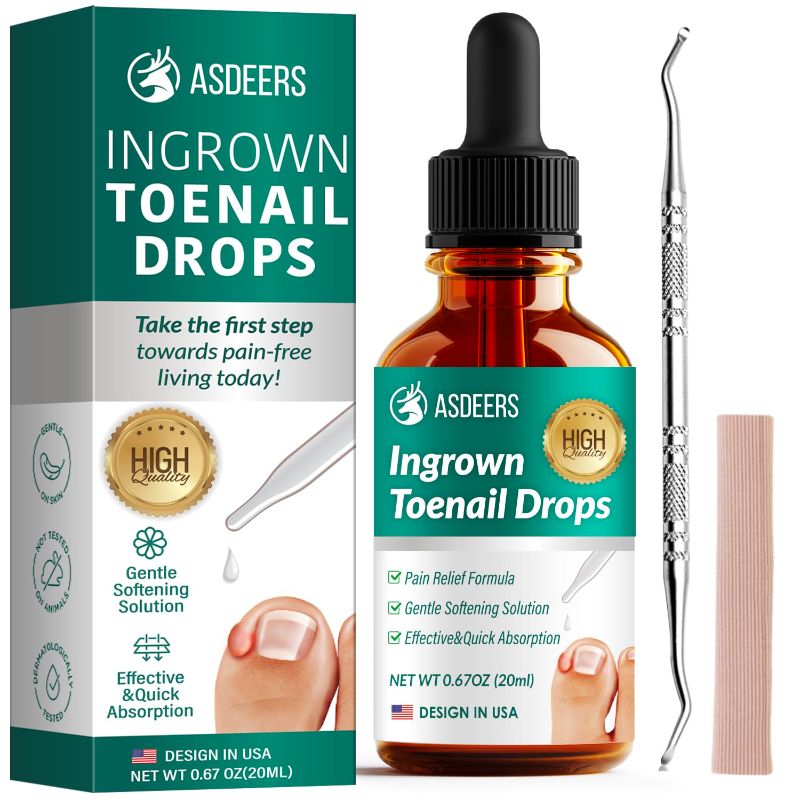 Photo 1 of Ingrown Toenail Treatment: Ingrown Toenail Removal Kit - Nail Toe Reliever and Softener Tools for Men Women - Corrector Drops Easy to Use at Home