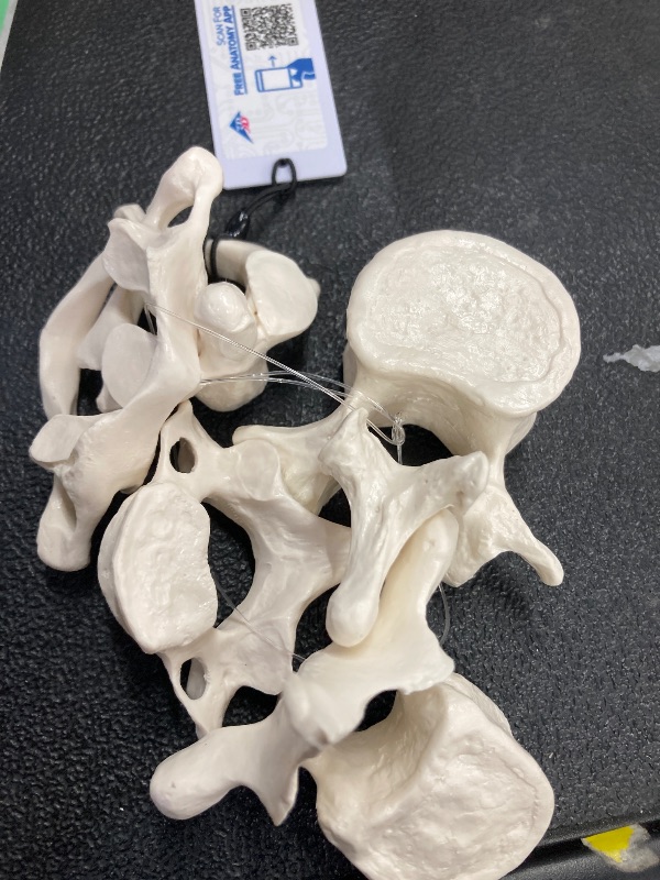 Photo 1 of 3B Scientific A75/1 5 Vertebrae - 3B Smart Anatomy