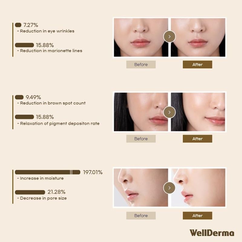 Photo 1 of WELLDERMA Sapphire Collagen Impact Fitting Mask, Hydrating Hydrogel Face Mask for Dry Skin, With Niacinamide and Marine Collagen, 4pcs
