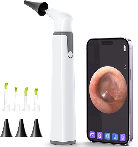 Photo 1 of ScopeAround Wireless Otoscope with Light Ear Camera, 3.9mm Ear Wax Removal Tool Camera, 720P HD with 6 LED Lights, WiFi Wireless Otoscope, Ear Scope Compatible with Android and iPhone