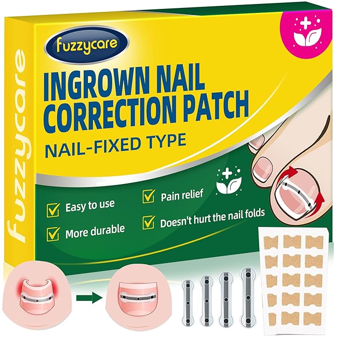 Photo 1 of Large Size-Titanium Alloy Ingrown Toenail Treatment & Removal Kit for Quick Relief, Ingrown Toenail Removal Kit? Professional Ingrown Toenail Corrector, Ingrown Toenail Tools for Quick Relief, 10 Pcs
