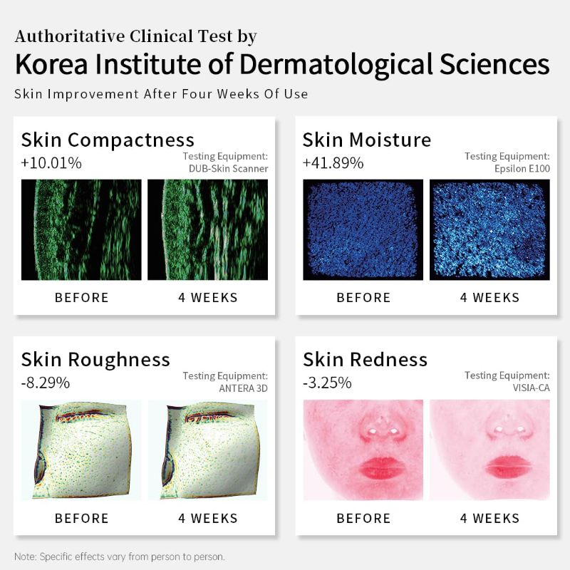 Photo 1 of LED Face Mask, 8 Color LED Mask for Face Skin Care, FSA/HSA Eligible, Red Light Mask for Face, Infrared, Red & Blue Light Mask, Wrinkle Reduction, Wireless. (Miracle ACE RB-050)